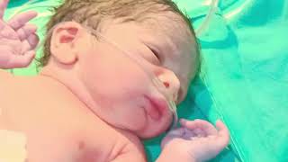 cyanosis 🥺 beautiful baby 🥰  #cryinglaughing #newbornbaby #trending @Amanmaurya_214