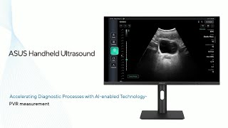 ASUS Handheld Ultrasound LU800 | Introduction to PVR measurement