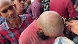 New Location Salman Salon Mandoli | Salman Mandoli | Hair Loss | Alopecia | Alopecia Areata