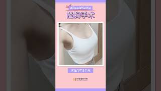 魔滴隆胸术前术后_真实案例  ＋唯一官V：theps1553