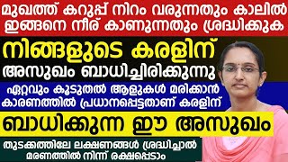 കരളിനെ ബാധിക്കുന്ന ഈ അസുഖം ഏറ്റവും കൂടുതൽ ആളുകൾ മരിക്കാൻ കാരണമാകുന്നതാണ്|