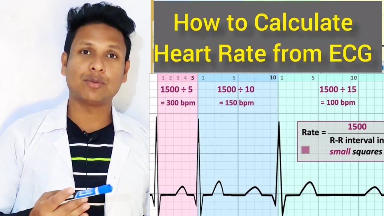 Heart Rate Calculation Ecg At Maddison Joyce Blog