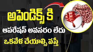 అపెండిక్స్ కి ఆపరేషన్ అవసరం లేదు  ఒకవేళ చేయాల్సి వస్తే | IDream doctors TV