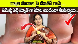 Ramaa Raavi : Remove Cracked Heels | Get Beautiful Feet | Soft Feet Remedy | Ramaa Raavi Health Tips