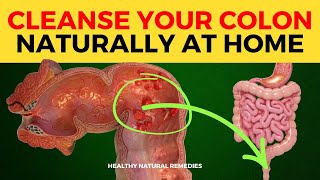 How to Cleanse Your Colon Naturally (Home Colon Cleanse)