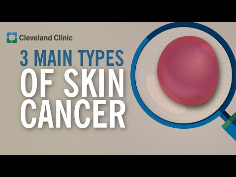 Is basal cell carcinoma malignant or benign?