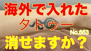 【ピコレーザー】海外で入れたタトゥーも治療可能！ピコレーザーによるタトゥー除去653【エンライトン】