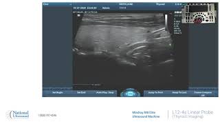 Mindray M8 Elite Ultrasound Thyroid Imaging Training Using a L12 4s Linear Probe