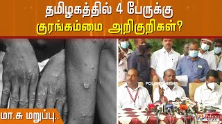 தமிழகத்தில் 4 பேருக்கு குரங்கம்மை அறிகுறிகள்?-மா.சு மறுப்பு