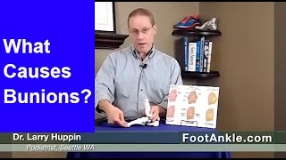 What Causes Bunions? | Seattle Podiatrist Dr. Larry Huppin