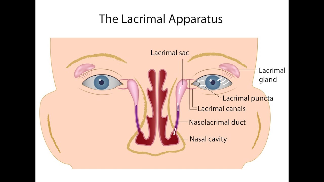 Nasolacrimal Duct Obstruction - YouTube