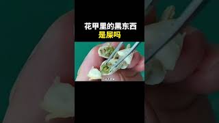 花甲中吃到的黑色东西是屎吗#科普#涨知识#花甲