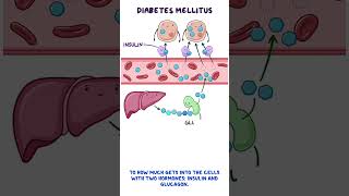 Clinical Cuts: Diabetes mellitus