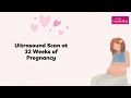 32 weeks pregnant symptoms baby growth do s and don ts