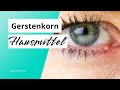 Gerstenkorn: 5 Hausmittel und Tipps