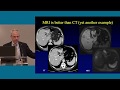 Metastatic Liver Disease: 2019 CURE OM Symposium