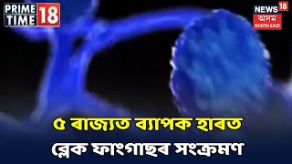 Assam News Updates | PRIME TIME18: ব্লেক ফাংগাছক মহামাৰী ঘোষণা