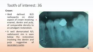 Radiographic interpretation made easy case 8 Solved examples