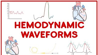 Hemodynamic Waveforms Made Simple