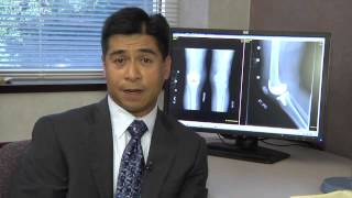 The FAQs of Knee Replacement Surgery with Dr. Ortiguera - Mayo Clinic