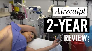 Airsculpt 2-Year Review: Would I do it all over again? (Before \u0026 After Included)