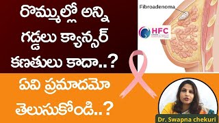 రొమ్ముల్లో అన్ని గడ్డలు క్యాన్సర్‌ కాదా..? || Are Lumps In Breast A Sign Of Cancer || Fibroadenomas