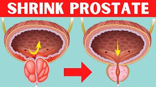 Top 8 Foods To Shrink Enlarge Prostate (Benign Prostatic Hyperplasia)