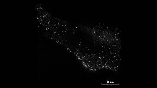 ケモカイン受容体の一分子蛍光観察 1    -   Single molecule fluorescence observation of chemokine receptor CXCR4-1