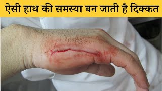 मशीन में हाथ आने के बाद बन गयी पेशेंट के लिए ऐसी समस्या | Hand surgery