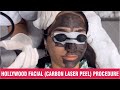 Hollywood Facial (Carbon Laser Peel) Procedure: Glowing Skin Treatment | Sakhiya Skin Clinic