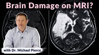 Will brain damage show on MRI?