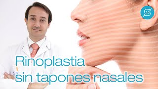 Rinoplastia sin tapones nasales | Dr. Francisco Solesio Alicante