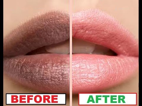 How To Get Soft Pink Lips Overnight | All About your Health How To Get Soft Pink Lips Overnight | All About your Health