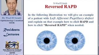 Reversed RAPD explained