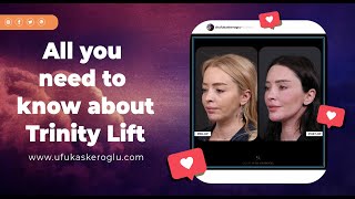 All you need to know about trinity lift - Fr