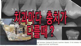 치톡 ] 충치 개수 다를 때  어떤 치과 선택 ?