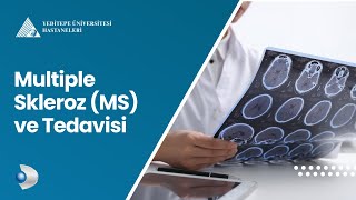 Multiple Skleroz (MS) ve Tedavisi