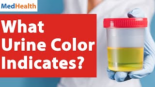 What Your Urine Color Indicates About Your Health | Urinary System Breakdown | MedHealth English