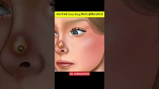 नाक में फसे Nose Ring को कैसे निकला जाता है 😱 #trending #hindi #shorts