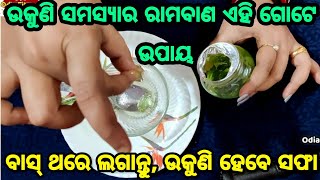 ଉକୁଣି ସମସ୍ଯାର ରାମବାଣ ଏହି ଗୋଟିଏ ଉପାୟ, ବାସ୍ ଲଗାନ୍ତୁ ଏହି ଗୋଟିଏ ଜିନିଷ ମୁଣ୍ଡରେ, ଉକୁଣି ହେବେ ସମ୍ପୂର୍ଣ୍ଣ ସଫ