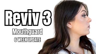 My First 6 Weeks Using the Reviv Mouthguard | Jaw Clenching & Face Update