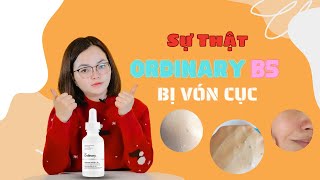 Serum HA + B5 Ordinary bị vón cục có phải hàng Fake ? Cách khắc phục nhanh nhất