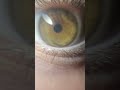 eye