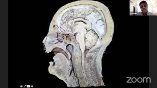 Microsurgical Anatomy of the Subarachnoid Cisterns