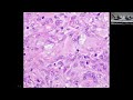 free pathology board review for pulmonary fellows