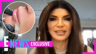 The Real Reason RHONJ’s Teresa Giudice Dissolved Her Lip Fillers (Exclusive) | E! News