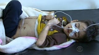 Aleppo boy finally gets surgery, two weeks after he was hurt in airstrike