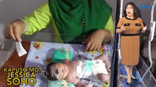 Kapuso Mo, Jessica Soho: BABY NA IISA LANG ANG MATA! KMJS FULL EPISODE MARCH 2024