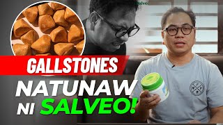 Natunaw ang gallstone dahil sa Salveo Barley Grass (Kwentong Salveo: Alvin Panganiban)