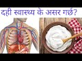 Curd health benefits in Nepali|Dr Bhupendra Shah|doctor sathi